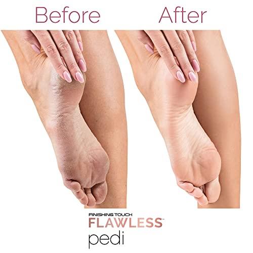 Finishing Touch Flawless Pedi Electronic Tool File and Callus Remover, Pedicure (New Version)