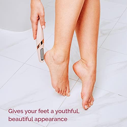 Finishing Touch Flawless Pedi Electronic Tool File and Callus Remover, Pedicure (New Version)