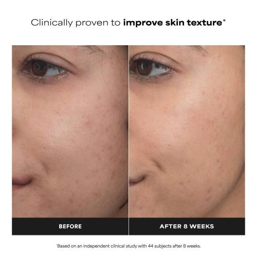 Paula's Choice Clinical PRO Retinaldehyde Dual-Retinoid Treatment for Clear, Luminous Skin