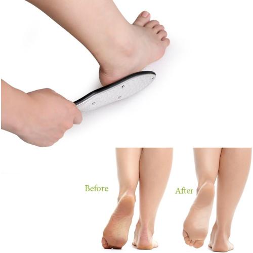 BEZOX Professional Foot File Callus Remover, Double Sided Pedicure Rasp for Cracked Heel and Dead Foot Skin - Heavy Duty Surgical Grade Stainless Steel - W/Cloth Storage Bag & Gift Box