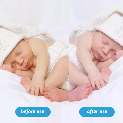 Jaundice Light Therapy Newborn Bilirubin Lamp Blanket Baby Neonatal Jaundice Treat Blue Ray Light 144LED Home