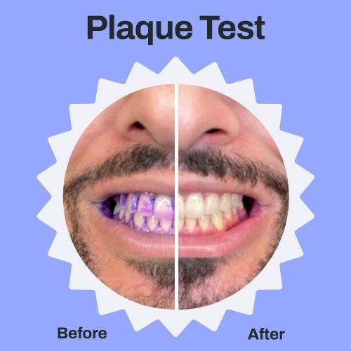 autobrush Sonic Pro Electric Toothbrush – Only ADA Accepted U-Shaped Brush, Clinically Proven Up to 5.1X Better Cleaning, 30-Second Full Mouth 360 Clean, Rechargeable, Waterproof, White, Men's Regular