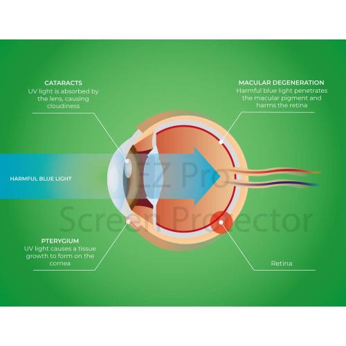 Premium Anti Blue Light Screen Filter for 32 Inches Computer Monitor, Screen Filter Size is 17.3 Height x29 Width, Blocks Harmful Blue Light, Reduce Digital Eye Strain Help Sleep Better
