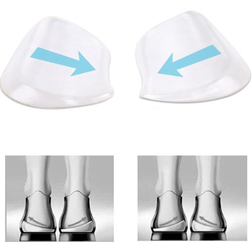 MARS WELLNESS Medial & Lateral Heel Wedge Silicone 2 Pairs - Universal - Adhesive Shoe Insert for Knock Knee Pain, Bow Legs, Foot Alignment - Pronation, Supination