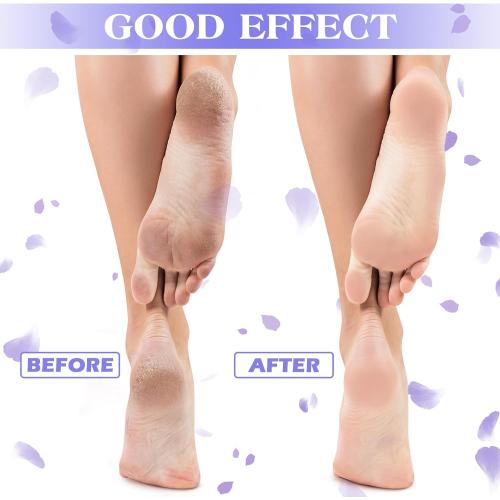 Tarpop 3 Pairs Aloe Socks Women Valentines Day Moisturizing Spa Socks for Dry Cracked Heel Feet Infused Gel Sleeping Fuzzy Lotion Gift for Women Men Softening Dry Feet(Purple and White)