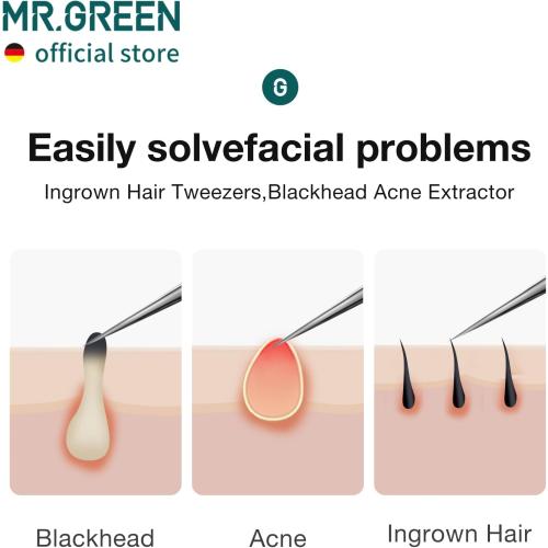 MR.GREEN Ingrown Hair Tweezers Needle Nose Pointed Tips Tweezers For Eyebrows Splinters Blackhead Removal Acne Clip Extractor (Long)