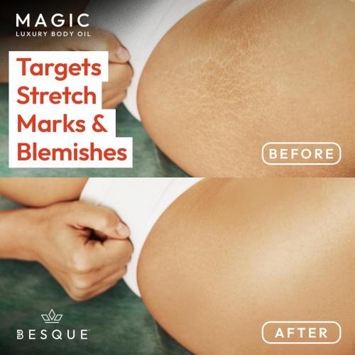 Besque Magic Body Oil, 3.4 FL OZ, After Shower Body Oil For Women, Hydrating Skin Care For Full Body That Plumps, Tightens, and Firms Skin With Natural Ingredients, Luxury Spa Gifts - Pack of 2