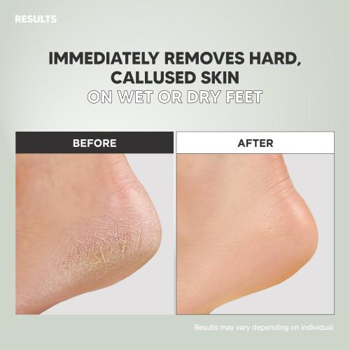 S-Line Emery Foot File, Colossal Double-Sided Pedicure Tool, Effective for Cracked Heel, Ergonomic Design for Easy Grip (White)