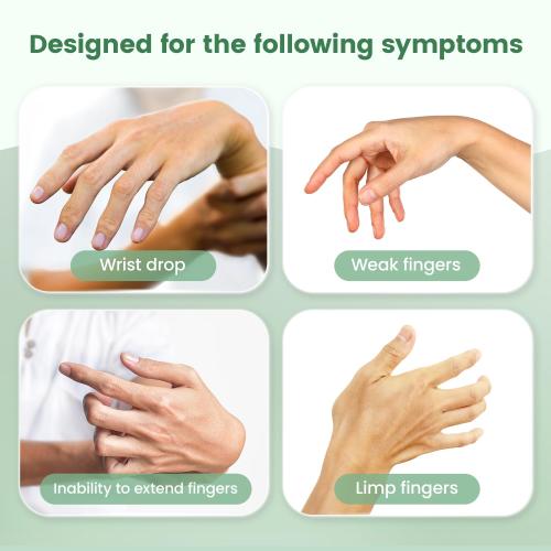Radial Nerve Palsy Brace Splint for Finger Extension, Wrist Drop, Crutch Palsy, Mcp Arthroplasty, Radial Nerve Injury, Finger Limp, Stroke Recovery, Adjustable Hand Stabilizer fit Right & Left Hand