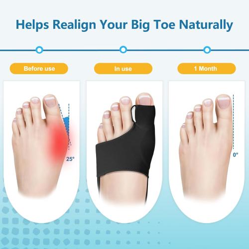 2-Pack Bunion Corrector for Women Big Toe, Big Toe Straightener, Instant Pain Relief, Wide Non-slip Strap Design, Soft and Breathable, Perfect for Everyday Wear.（M）