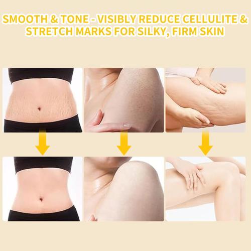 Handheld Electric Lymphatic Drainage Massager: Body Sculpting Machine and Anti Cellulite Massage Tool for Cellulite & Stretch Marks with Microcurrent Red Light Heat & Vibration