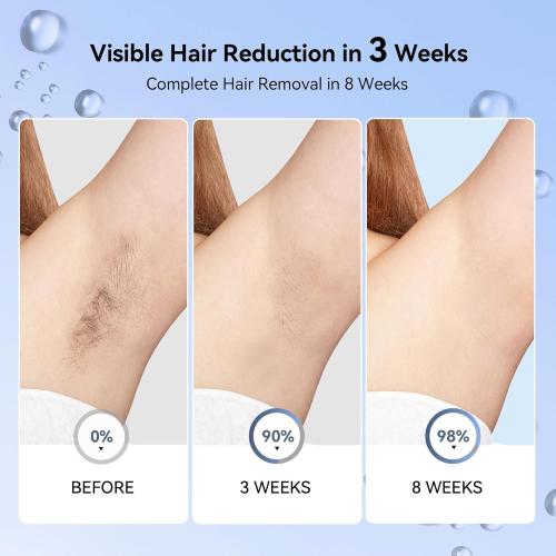 Laser Hair Removal for Women, IPL Laser Hair Removal Device, Painless Hair Remover at Home with Sapphire Ice-Cooling, Long-Lasting Hair Reduction in 3 Weeks for Face Body Bikini, Gifts for Women Her