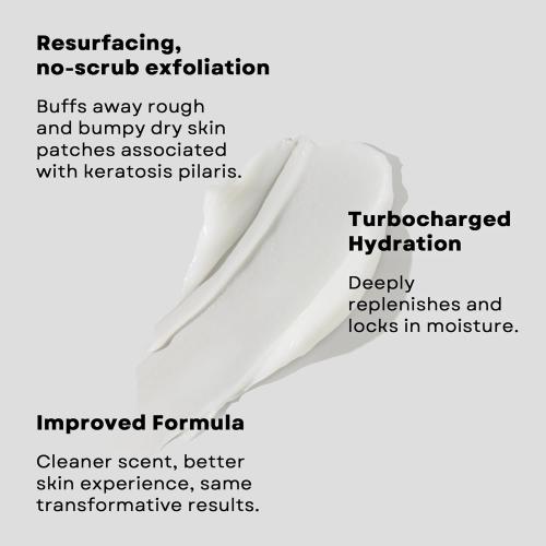 AmLactin KP Bumps Be Gone - Therapeutic Body Cream for Keratosis Pilaris - No-Scrub Exfoliator and Moisturizer with 15% Lactic Acid AHA, 3 oz (Packaging May Vary)​