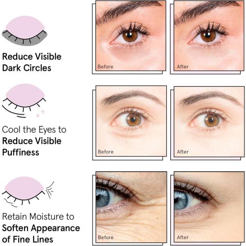 grace & stella Under Eye Patches (12 pairs) Eye Masks for Puffy Eyes and Dark Circles - Gifts for Women, Bridesmaids, Birthdays, Bachelorette Party, Self Care Gifts for Women - Vegan Cruelty-Free