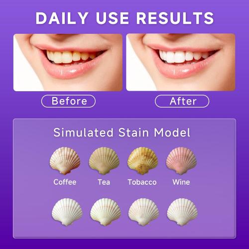 SAKYPRORAL Purple Toothpaste for Ultra Teeth Whitening, Peroxide Free & Fluoride Free, Enamel-Safe for Sensitive Teeth, Instant Brightening, 24-Hour Stain Defense, Fresh Mint, 1 Pack, 3.88 oz