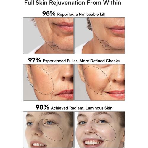 INIA 3-in-1 Skin Tightening Device True Beauty Glow Facial Massager Red Light Therapy for Face and Neck