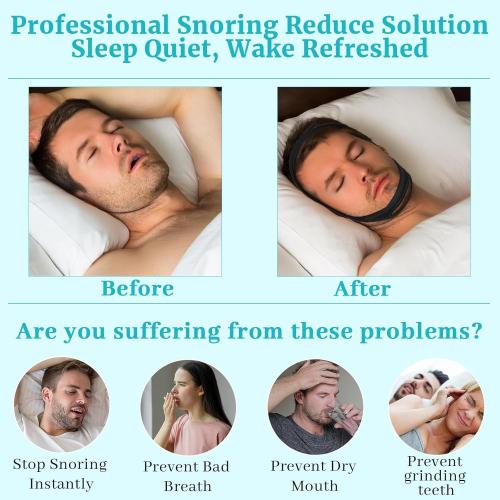 Anti Snoring Chin Strap for Sleeping, 2 Pack Adjustable Jaw Support Strap to Keep Mouth Closed, Soft Snoring Solution for Women Men, Stops Snoring Dry Mouth