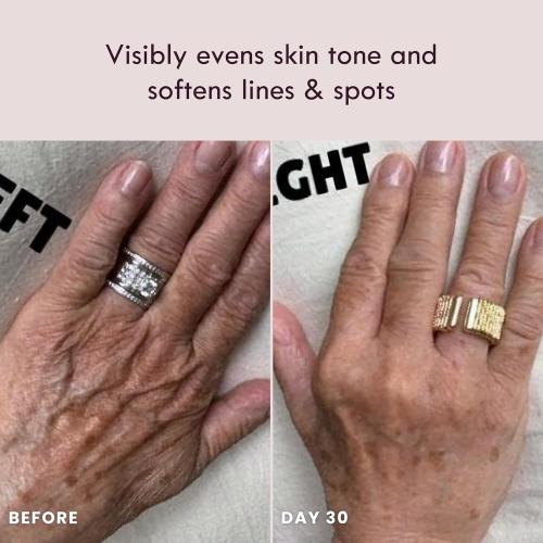 Laduora Lumeo 4-in-1 SkinLift Beauty Device   Serum Kit | Pro Glow System for Face & Neck