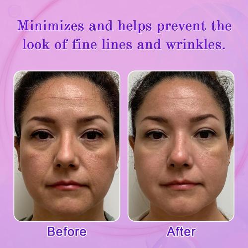 Facial Wrinkle Patches, Anti Wrinkle Patches for Forehead, Face, Frown Lines, Smile Lines, Overnight Wrinkle Pads to Reduce Fine Lines, Reusable Anti-Aging Face Patches, 160 pcs