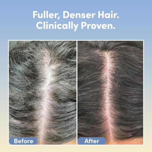 Coco & Eve Boost Therapy Tripeptide Hair Density Serum. For Thicker, Fuller Hair. Anti-Hair Loss & Shedding, Lightweight Scalp Treatment with Biotin & Caffeine for Volume & Restoration (2.03 Fl Oz)