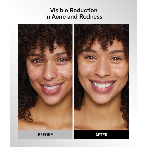 INIA Red Light Therapy Mask for Face, Glow Wireless LED Face Mask Light Therapy with Near-Infrared Red Light (NIR), Rechargeable and Ergonomic Design for Home & Travel