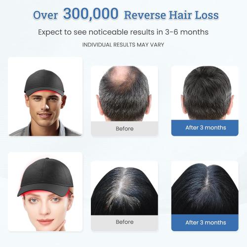Laser Hair Growth Cap TW316