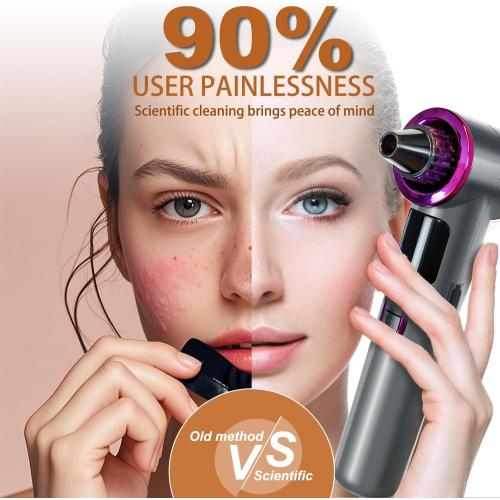 Blackhead Remover Vacuum with Heating, Blackhead Extractor 3 Adjustable Suction Levels 9 Modes, Pore Vacuum Blackhead Suction Remover, Comedone Extractor Kit for Deep Pore Cleaning - Purple