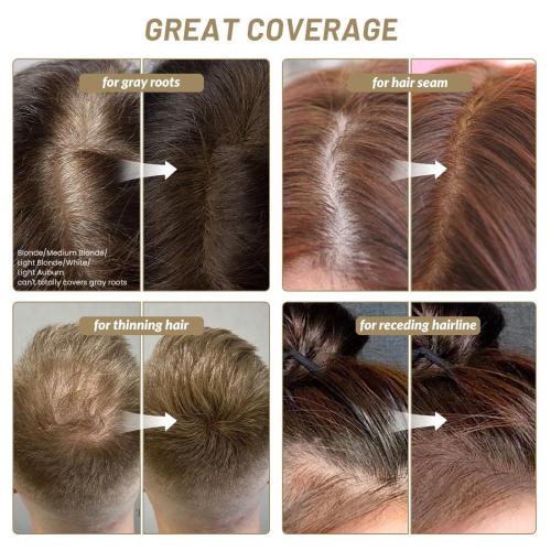 SOVONCARE Hairline Powder - Root Touch Up & Gray Hair Concealer for Men and Women, Instantly Covers Thinning Hair and Bald Spots, Natural-Looking Coverage Medium Brown