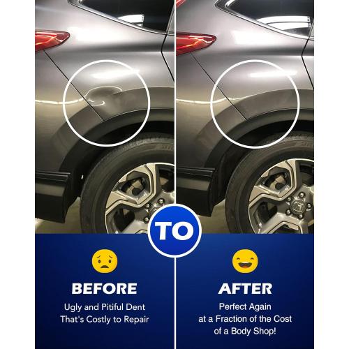 Blue Orion Motor Tech Heavy Duty Slide Hammer Dent Puller Set, Auto Body Removal Kit With 9 Attachments, 14pc Car Remover Tools for Cars Trucks More