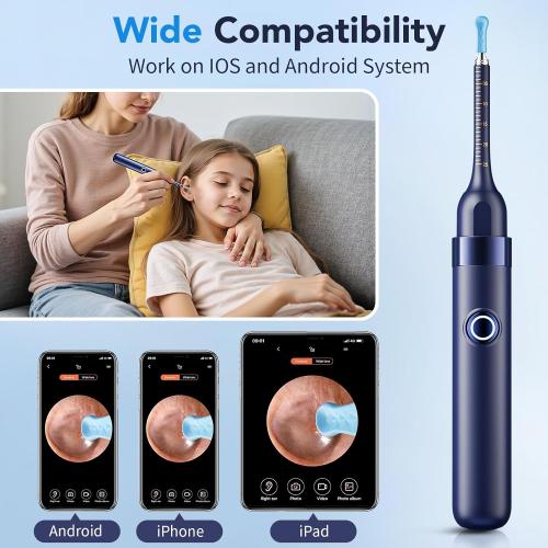 Ear Wax Removal, Ear Cleaner with Camera 1296P HD,Visual Ear Cleaner with 6 LED Lights and Flexible Tip,FSA HSA Eligible Items,Safe Ear Wax Removal Kit with Camera,Ear Cleaning Tool for Family Gifts