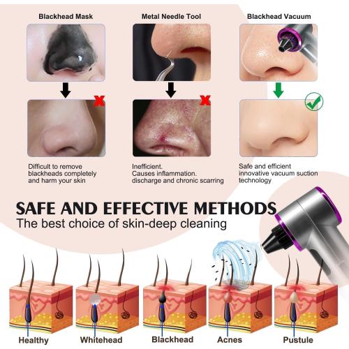 Blackhead Remover Vacuum with Heating, Blackhead Extractor 3 Adjustable Suction Levels 9 Modes, Pore Vacuum Blackhead Suction Remover, Comedone Extractor Kit for Deep Pore Cleaning - Purple