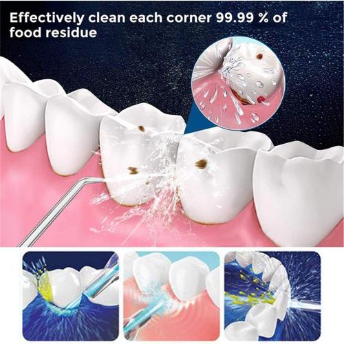Water flossers for Teeth,Water flosser Portable for Braces,Manual Water flosser Cordless,Dental Floss for Bridges,Teeth Cleaning kit (3 Heads)
