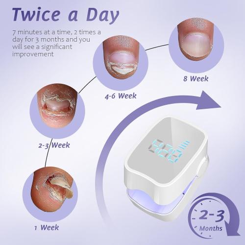 Nail Fungus Laser Treatment LED Light Device - Toenail Fungus Treatment, Solution for Damaged Discoloration of Thick Toenails and Fingernails, White