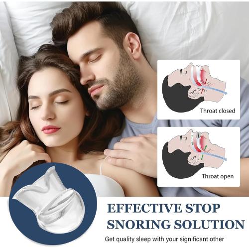 Snoring Solution - Anti-Snore Device, Reusable Snore Solution Stopper for Men/Women - MF32