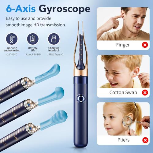 Ear Wax Removal, Ear Cleaner with Camera 1296P HD,Visual Ear Cleaner with 6 LED Lights and Flexible Tip,FSA HSA Eligible Items,Safe Ear Wax Removal Kit with Camera,Ear Cleaning Tool for Family Gifts