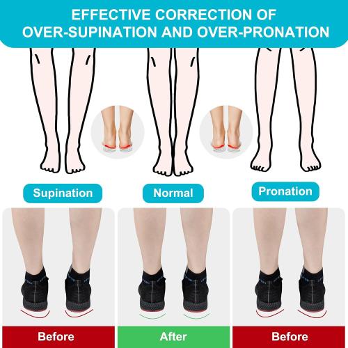 2 Pairs Wonderwin 3 Layers Adjustable Heel Wedge Inserts for Supination & Pronation Correction - Silicone Medial & Lateral Heel Insoles for Bow Legs, Knee Pain, Foot Alignment(Small)