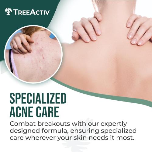 Back Acne Spray, 2% Salicylic Acid (BHA) Body Acne Spray, Fast-Drying Tea Tree Oil   Aloe Mist for Back, Chest, Shoulders & Butt, 4 fl oz