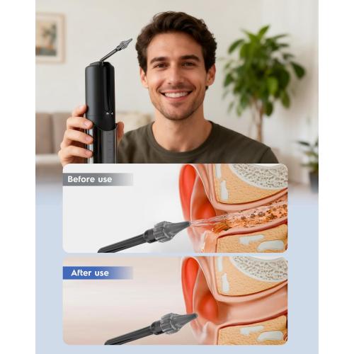 Upgraded Ear Wax Removal, Ear Cleaner - Safe and Efficient Ear Cleaning Kit, 4 Pressure Modes, 10 nozzles, Electric Earwax Cleaning Kit for Earwax Buildup