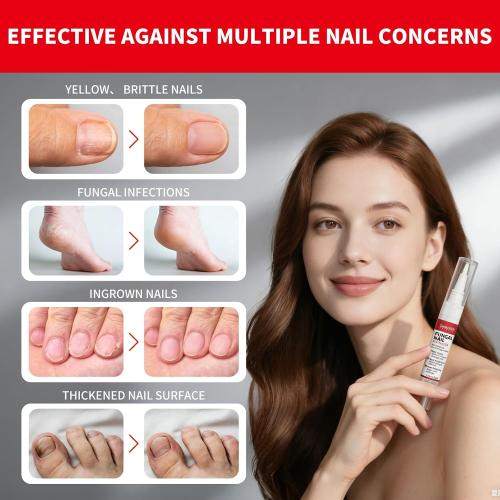 Toenail Fungus Pen Treatment Extra Strength, Nail Fungal Repair Pen for Damaged Nails Yellow, Discolored, Thick and Ingrown Nails, Nail Fungi Pen with Tea Tree Oil for Toenails and Fingernail, 3 Pens