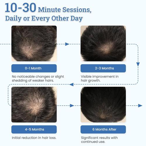 Laser Hair Growth Cap TW316