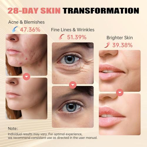 Red Light Therapy for Face, Near-lnfrared 850 LED Face Mask Light Therapy 3 Modes Portable Led Face Mask Light Therapy with Rechargeable Remote, Red Light Therapy Mask with Timing Function
