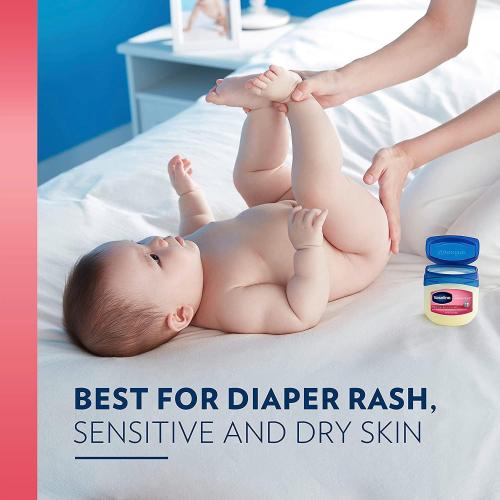 13oz 4 PackVaseline Petroleum Jelly Baby Skincare Protective & Pure 4 Count Treats Dry Skin And Prevents Chaffed Skin From Diaper Rash Hypoallergenic And Gentle On Skin 13oz