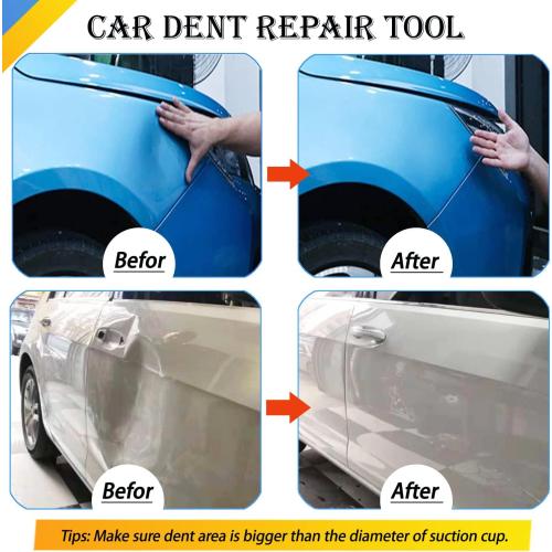 Car Dent Puller,Powerful Car Dent Puller, Car Dent Removal Kit,Dent Remover Tool for Car Dent Repair, Glass, Screen, Tiles Lifting and Objects Moving (Orange Black)