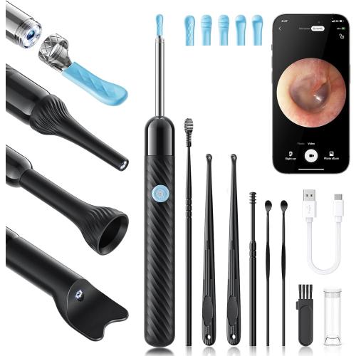 Loyker X6 Ear Wax Removal Tool Camera, Ear Cleaner with Camera, FSA - HSA Store Eligible, 1080P Ear Camera with 6LED Light for Ear/Nose/Throat/Tonsil Stone Examination, Black