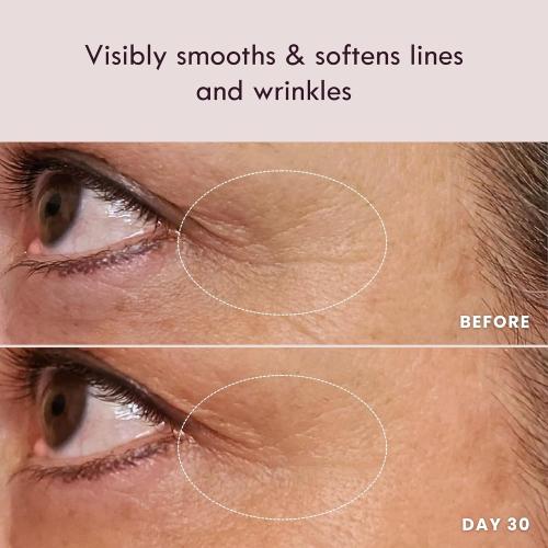 Laduora Lumeo 4-in-1 SkinLift Beauty Device   Serum Kit | Pro Glow System for Face & Neck