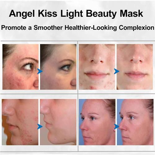 Light Beauty Mask - Led Face Mask Light Therapy - Red Light Therapy Mask for Face - LED Facial Skin Care Mask