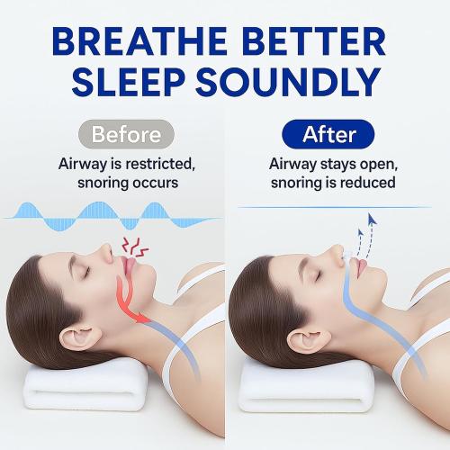 Anti Snoring Devices, Adjustable Snore Stopper for Men and Women, 3-Gear Fit for Personalized Comfort, Individually Packaged & Reusable – 4 Pack