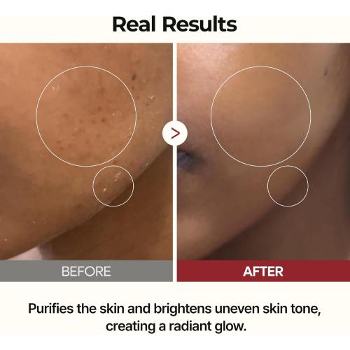 Dr.Melaxin Peel Shot Glow Rice Toner 200ml hydrated Skin Cleansing Skin Korean Skin Care
