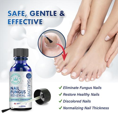 Toenail Fungus Treatment At Home: Nail Fungus Treatment Extra Strength Fast Acting One Week - Safely Repair Renew Damaged And Discolored Toenails - Effectively Improve Athlete's Nail Health