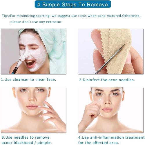 5PCS Blackhead Remover Comedone Extractor, Curved Blackhead Tweezers Kit, Professional Stainless Pimple Acne Blemish Removal Tools Kit for Manual